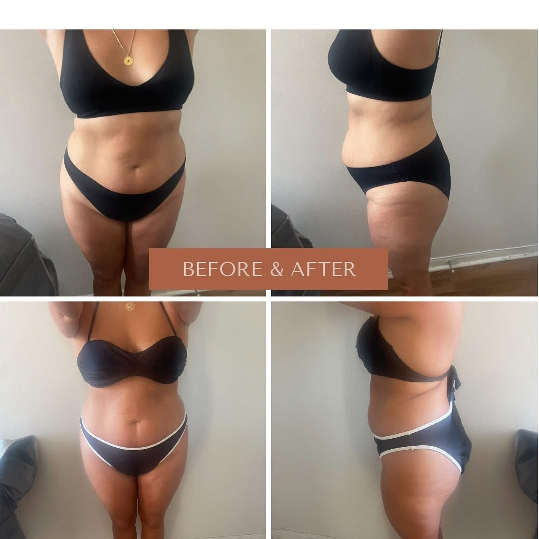 Before and after collage - multiple angles